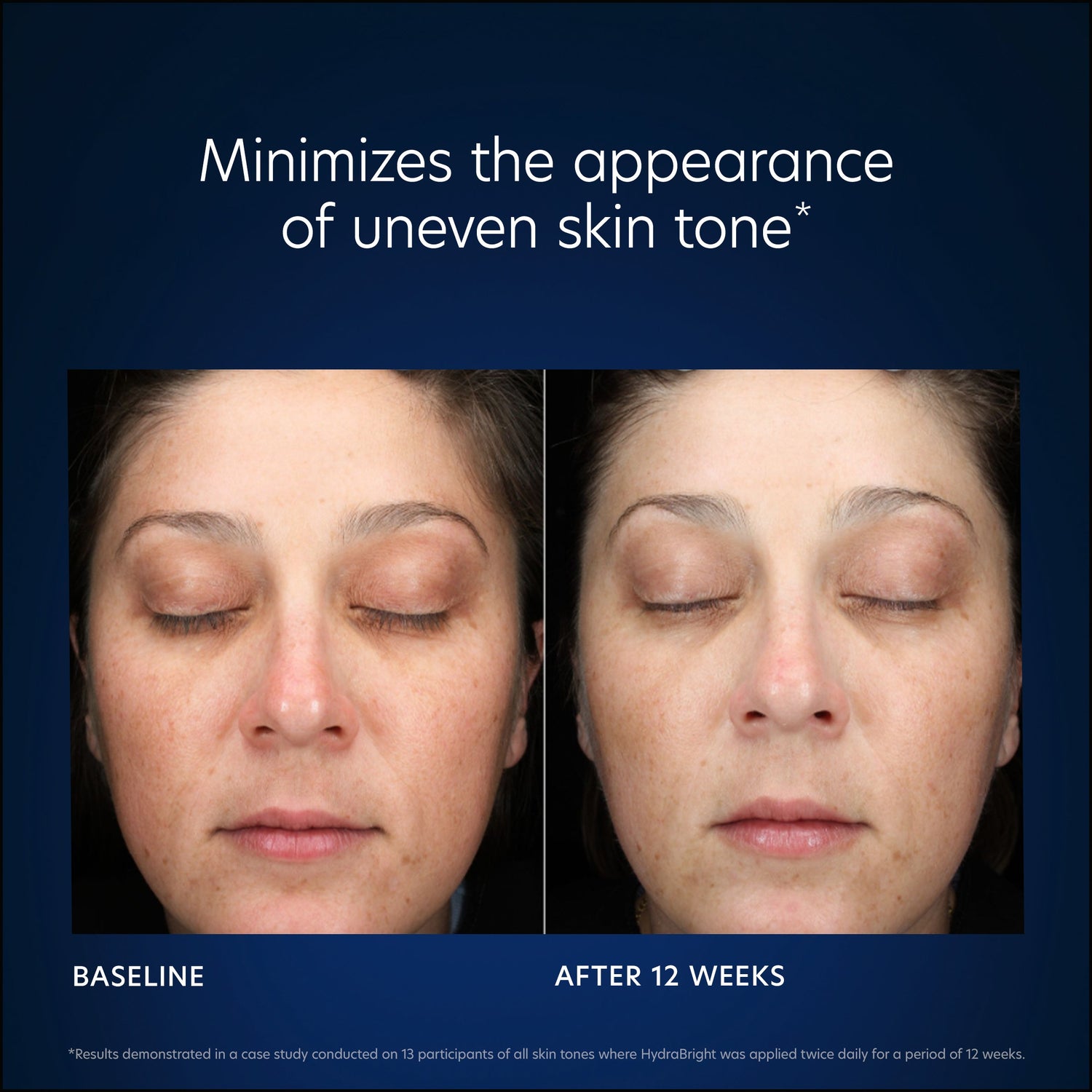 Side-by-side photos of a woman’s face with eyes closed show fewer dark spots and a more radiant, even skin tone after 12 weeks of using HydraBright 50 ml compared to her baseline uneven complexion.